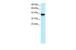 NFYA Antibody, Novus Biologicals 100 &mu;L; Unconjugated:Antibodies, Polyclonal
